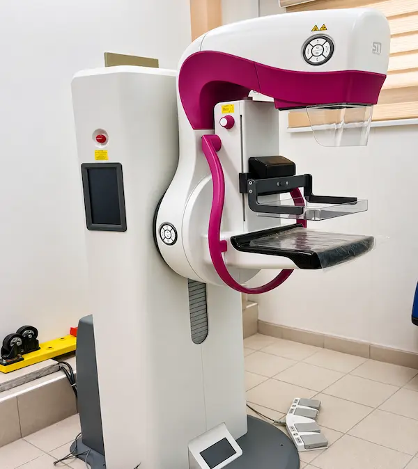 Digital Mammography
